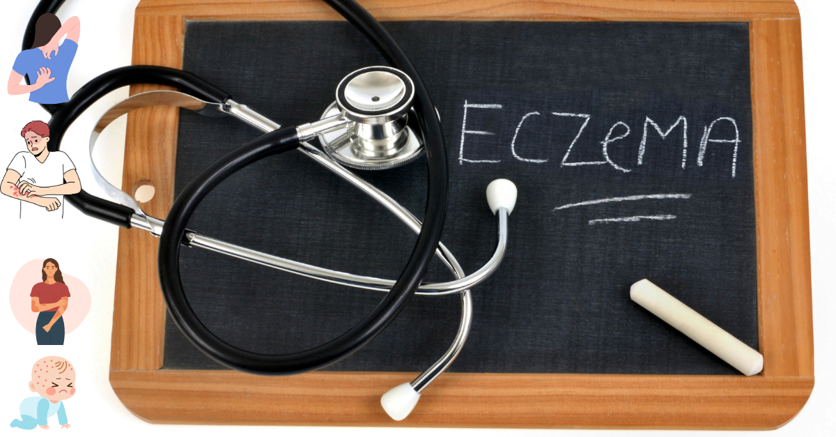 Eczema Management: 6 Tips for the best creams & Moisturizer | Swiftly Found